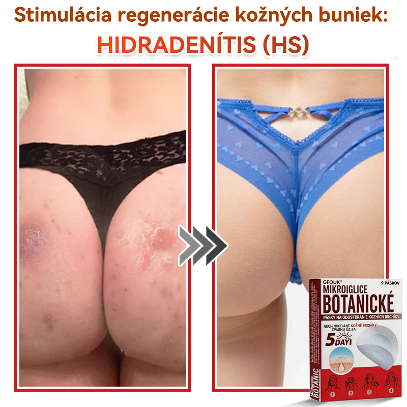 🔥🔥✅GFOUK® MicroNeedle botanic náplasť na odstránenie kožných výrastkov Vyrobené