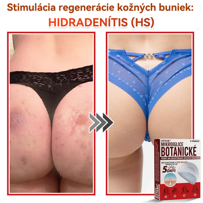 🔥🔥✅GFOUK® MicroNeedle botanic náplasť na odstránenie kožných výrastkov Vyrobené