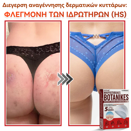 🗽✅ GFOUK® MicroNeedle Botanic επίθεμα για την αφαίρεση δερματικών θηλωμάτων