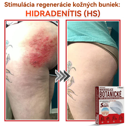 🔥🔥✅GFOUK® MicroNeedle botanic náplasť na odstránenie kožných výrastkov Vyrobené