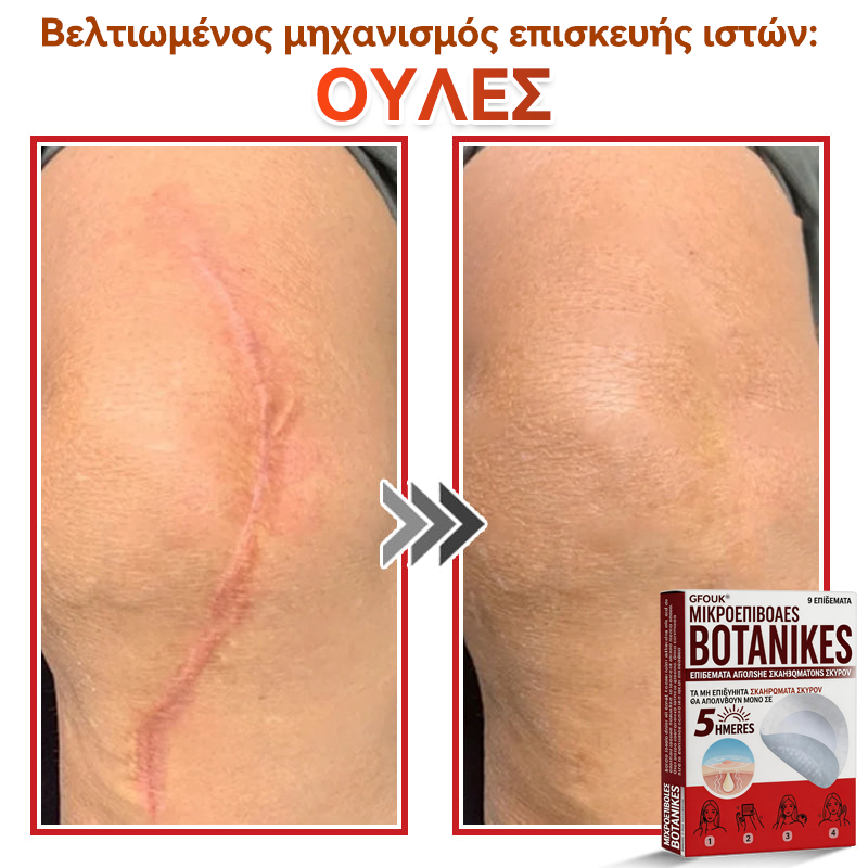 🗽✅ GFOUK® MicroNeedle Botanic επίθεμα για την αφαίρεση δερματικών θηλωμάτων