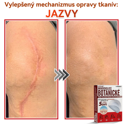 🔥🔥✅GFOUK® MicroNeedle botanic náplasť na odstránenie kožných výrastkov Vyrobené