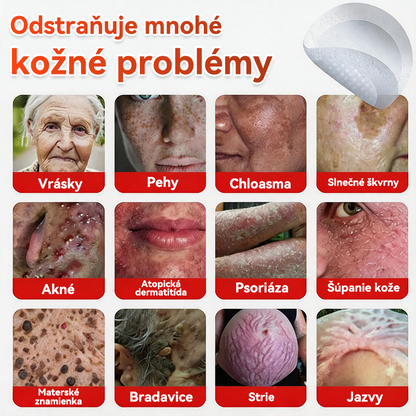 🔥🔥✅GFOUK® MicroNeedle botanic náplasť na odstránenie kožných výrastkov Vyrobené
