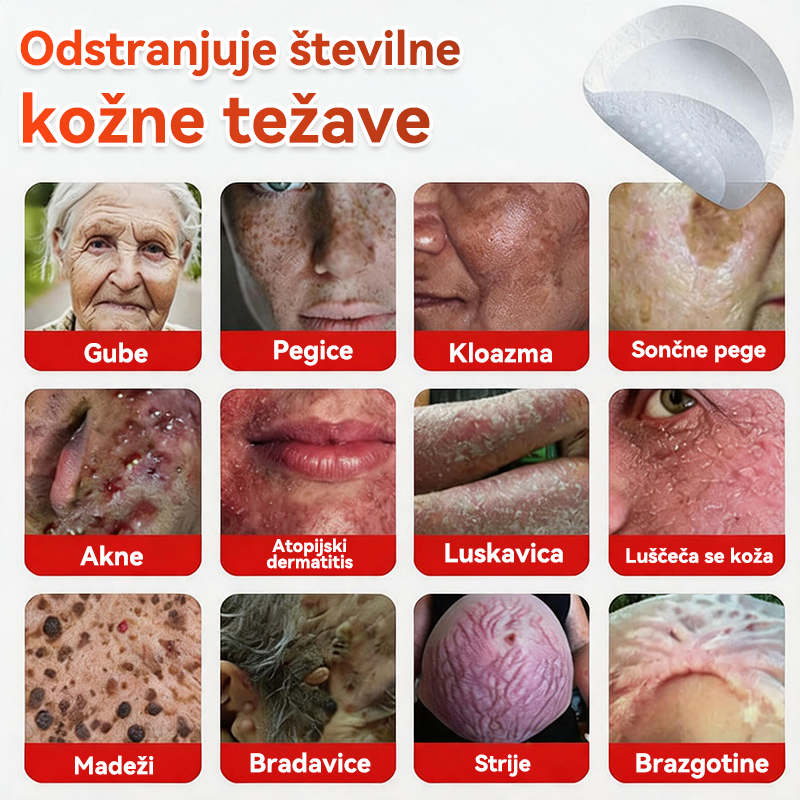 🗽✅GFOUK®Botanični obliž z mikroiglami za odstranjevanje kožnih izrastkov