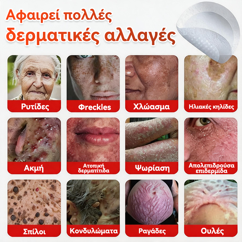 🗽✅ GFOUK® MicroNeedle Botanic επίθεμα για την αφαίρεση δερματικών θηλωμάτων