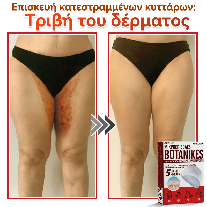🗽✅ GFOUK® MicroNeedle Botanic επίθεμα για την αφαίρεση δερματικών θηλωμάτων