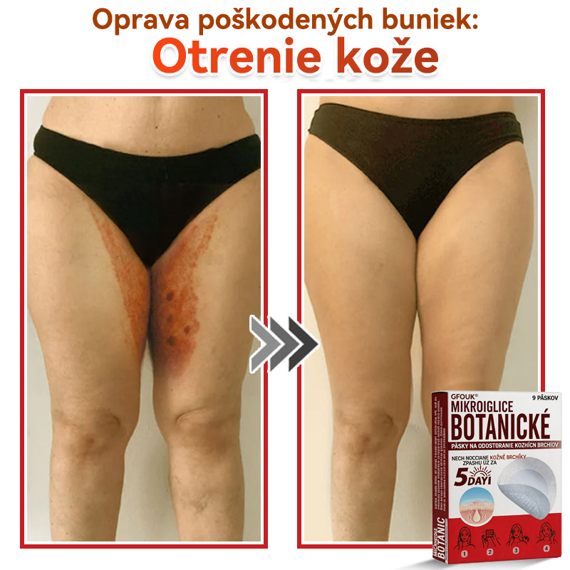 🔥🔥✅GFOUK® MicroNeedle botanic náplasť na odstránenie kožných výrastkov Vyrobené