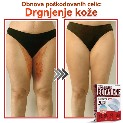 🗽✅GFOUK®Botanični obliž z mikroiglami za odstranjevanje kožnih izrastkov