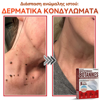 🗽✅ GFOUK® MicroNeedle Botanic επίθεμα για την αφαίρεση δερματικών θηλωμάτων