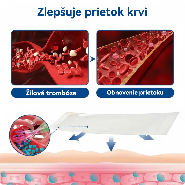 👨‍⚕️✅ TAILEDEN® VeinEase mikronáplasť s mikroihličkami ⚡ Okamžitá úľava, dlhodobé výsledky