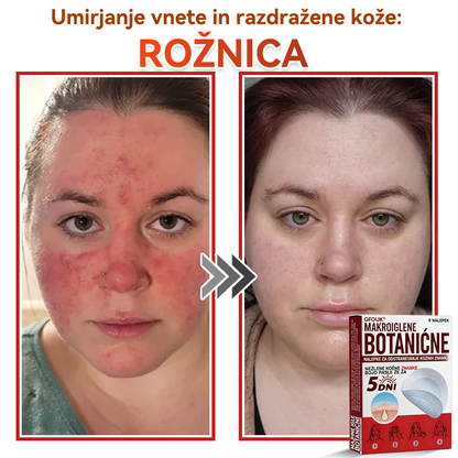 🗽✅GFOUK®Botanični obliž z mikroiglami za odstranjevanje kožnih izrastkov