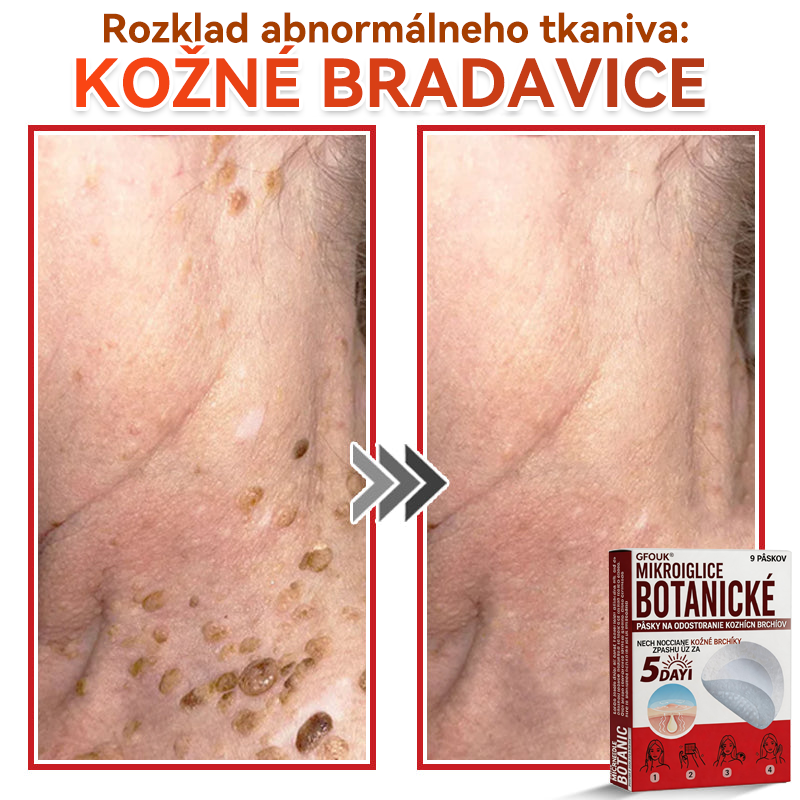 🔥🔥✅GFOUK® MicroNeedle botanic náplasť na odstránenie kožných výrastkov Vyrobené