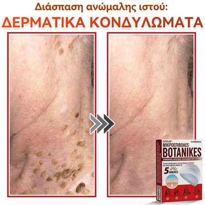🗽✅ GFOUK® MicroNeedle Botanic επίθεμα για την αφαίρεση δερματικών θηλωμάτων