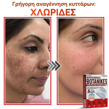 🗽✅ GFOUK® MicroNeedle Botanic επίθεμα για την αφαίρεση δερματικών θηλωμάτων