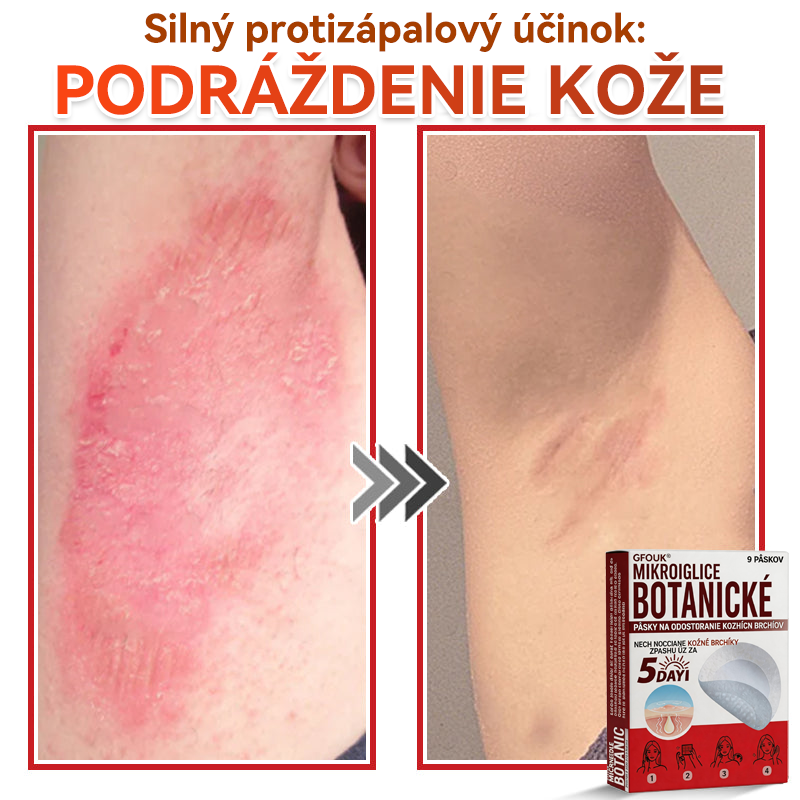 🔥🔥✅GFOUK® MicroNeedle botanic náplasť na odstránenie kožných výrastkov Vyrobené