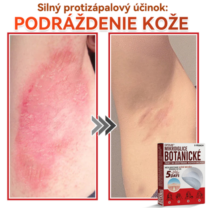 🔥🔥✅GFOUK® MicroNeedle botanic náplasť na odstránenie kožných výrastkov Vyrobené