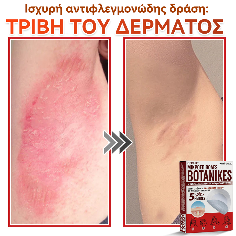 🗽✅ GFOUK® MicroNeedle Botanic επίθεμα για την αφαίρεση δερματικών θηλωμάτων
