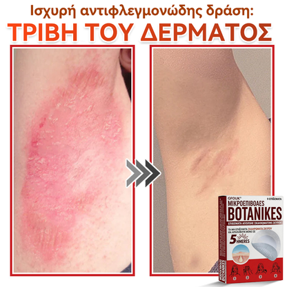 🗽✅ GFOUK® MicroNeedle Botanic επίθεμα για την αφαίρεση δερματικών θηλωμάτων